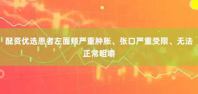 配资优选患者左面颊严重肿胀、张口严重受限、无法正常咀嚼