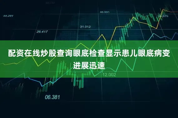 配资在线炒股查询眼底检查显示患儿眼底病变进展迅速