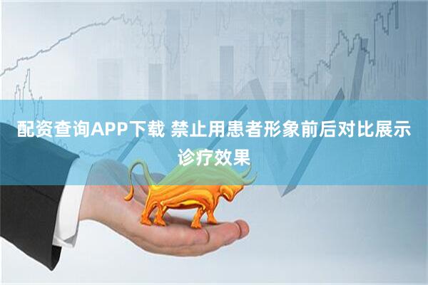 配资查询APP下载 禁止用患者形象前后对比展示诊疗效果